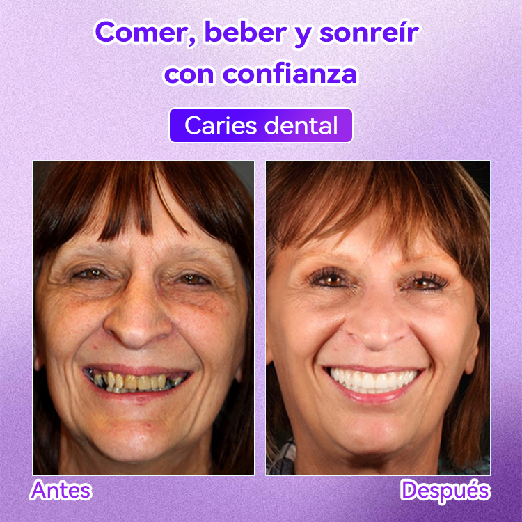 Tienda Oficial🌌|𝙳𝖺𝑟𝑚𝗼𝑟𝑛𝖺® 𝘋𝘪𝘦𝘯𝘵𝘦 𝘙𝘦𝘱𝘢𝘳𝘢𝘳 𝘔𝘪𝘯𝘦𝘳𝘢 𝘗𝘰𝘭𝘷𝘰-𝐸𝑛𝑐í𝑎𝑠 𝑚á𝑠 𝑓𝑢𝑒𝑟𝑡𝑒𝑠 𝑒𝑛 𝑠𝑜𝑙𝑜 7 𝑑í𝑎𝑠