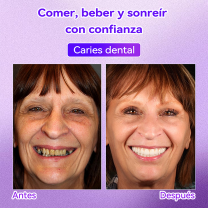 Tienda Oficial🌌|𝙳𝖺𝑟𝑚𝗼𝑟𝑛𝖺® 𝘋𝘪𝘦𝘯𝘵𝘦 𝘙𝘦𝘱𝘢𝘳𝘢𝘳 𝘔𝘪𝘯𝘦𝘳𝘢 𝘗𝘰𝘭𝘷𝘰-𝐸𝑛𝑐í𝑎𝑠 𝑚á𝑠 𝑓𝑢𝑒𝑟𝑡𝑒𝑠 𝑒𝑛 𝑠𝑜𝑙𝑜 7 𝑑í𝑎𝑠