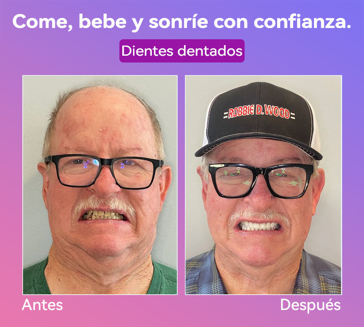 𝐉𝐚𝐬𝐬𝐞𝐞𝐦® Últimas Prótesis Premium de Confort🎁🎁 (Prótesis de Alta Gama, Cómodas de Usar - Descuento por Tiempo Limitado del 70%)