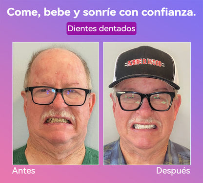 𝐉𝐚𝐬𝐬𝐞𝐞𝐦® Últimas Prótesis Premium de Confort🎁🎁 (Prótesis de Alta Gama, Cómodas de Usar - Descuento por Tiempo Limitado del 70%)