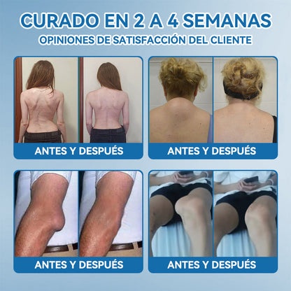 Picdo® BPC-157 Crema para la Curación de Articulaciones 💕 Trata eficazmente la artritis, la neuropatía, el reumatismo, las lesiones deportivas y más 👩‍⚕️🏆
