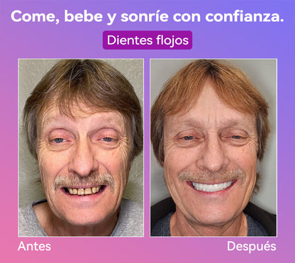 𝐉𝐚𝐬𝐬𝐞𝐞𝐦® Últimas Prótesis Premium de Confort🎁🎁 (Prótesis de Alta Gama, Cómodas de Usar - Descuento por Tiempo Limitado del 70%)