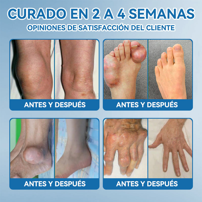 Picdo® BPC-157 Crema para la Curación de Articulaciones 💕 Trata eficazmente la artritis, la neuropatía, el reumatismo, las lesiones deportivas y más 👩‍⚕️🏆