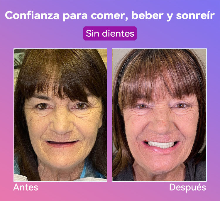 𝐉𝐚𝐬𝐬𝐞𝐞𝐦® Últimas Prótesis Premium de Confort🎁🎁 (Prótesis de Alta Gama, Cómodas de Usar - Descuento por Tiempo Limitado del 70%)