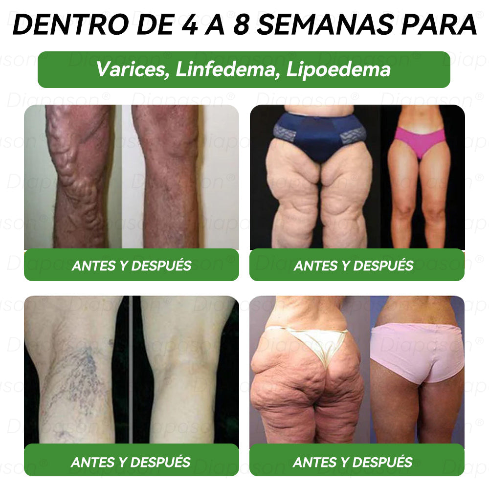 Tienda Oficial | 🍎𝐃𝒊𝓪𝐩𝓪𝙨𝐨𝒏®Ｇ𝖫𝑃-𝟏 𝑆𝑖𝑒𝑡𝑒 𝑒𝑛 𝑢𝑛𝑜 𝑆𝑜𝑙𝑢𝑐𝑖ó𝑛 𝑃𝑎𝑟𝑎 𝑙𝑎 𝑆𝑎𝑙𝑢𝑑 𝐿í𝑞𝑢𝑖𝑑𝑜 𝑂𝑟𝑎𝑙(Solo una vez al día, cambios visibles en 7 días) Para obesidad, salud cardiovascular, diabetes, apnea del sueño, salud intestinal, problemas articulares y más