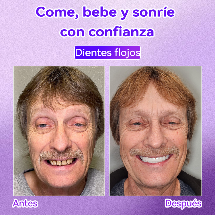 Tienda Oficial🌌|𝙳𝖺𝑟𝑚𝗼𝑟𝑛𝖺® 𝘋𝘪𝘦𝘯𝘵𝘦 𝘙𝘦𝘱𝘢𝘳𝘢𝘳 𝘔𝘪𝘯𝘦𝘳𝘢 𝘗𝘰𝘭𝘷𝘰-𝐸𝑛𝑐í𝑎𝑠 𝑚á𝑠 𝑓𝑢𝑒𝑟𝑡𝑒𝑠 𝑒𝑛 𝑠𝑜𝑙𝑜 7 𝑑í𝑎𝑠