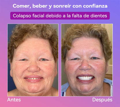 𝐉𝐚𝐬𝐬𝐞𝐞𝐦® Últimas Prótesis Premium de Confort🎁🎁 (Prótesis de Alta Gama, Cómodas de Usar - Descuento por Tiempo Limitado del 70%)