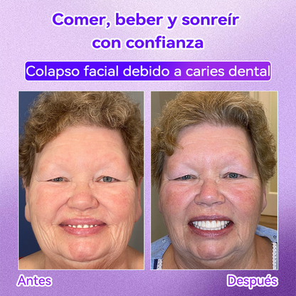 Tienda Oficial🌌|𝙳𝖺𝑟𝑚𝗼𝑟𝑛𝖺® 𝘋𝘪𝘦𝘯𝘵𝘦 𝘙𝘦𝘱𝘢𝘳𝘢𝘳 𝘔𝘪𝘯𝘦𝘳𝘢 𝘗𝘰𝘭𝘷𝘰-𝐸𝑛𝑐í𝑎𝑠 𝑚á𝑠 𝑓𝑢𝑒𝑟𝑡𝑒𝑠 𝑒𝑛 𝑠𝑜𝑙𝑜 7 𝑑í𝑎𝑠