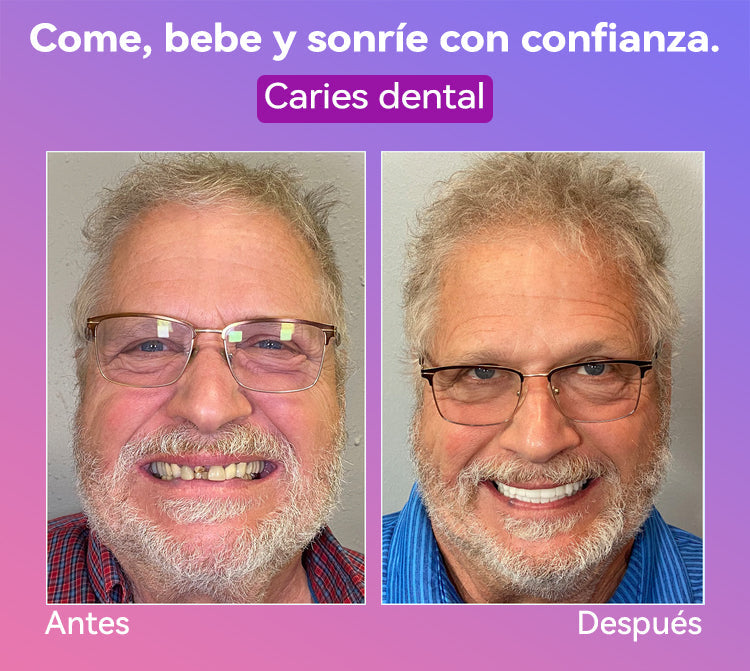 𝐉𝐚𝐬𝐬𝐞𝐞𝐦® Últimas Prótesis Premium de Confort🎁🎁 (Prótesis de Alta Gama, Cómodas de Usar - Descuento por Tiempo Limitado del 70%)