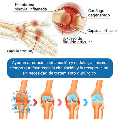 Picdo® BPC-157 Crema para la Curación de Articulaciones 💕 Trata eficazmente la artritis, la neuropatía, el reumatismo, las lesiones deportivas y más 👩‍⚕️🏆