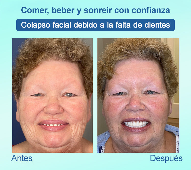 𝐉𝐚𝐬𝐬𝐞𝐞𝐦®🍀𝐷𝑒𝑛𝑡𝑎𝑑𝑢𝑟𝑎 𝑃𝑜𝑠𝑡𝑖𝑧𝑎 𝑃𝑟𝑒𝑚𝑖𝑢𝑚(🦷𝐷𝑒𝑠𝑐𝑢𝑒𝑛𝑡𝑜 𝑝𝑜𝑟 𝑡𝑖𝑒𝑚𝑝𝑜 𝑙𝑖𝑚𝑖𝑡𝑎𝑑𝑜 Ú𝑙𝑡𝑖𝑚𝑜𝑠 30 𝑚𝑖𝑛𝑢𝑡𝑜𝑠🦷)