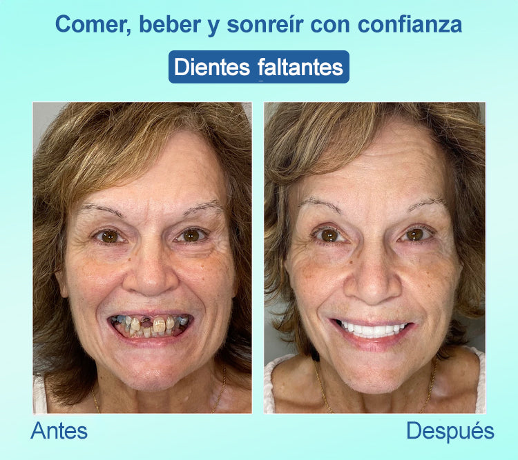 𝐉𝐚𝐬𝐬𝐞𝐞𝐦®🍀𝐷𝑒𝑛𝑡𝑎𝑑𝑢𝑟𝑎 𝑃𝑜𝑠𝑡𝑖𝑧𝑎 𝑃𝑟𝑒𝑚𝑖𝑢𝑚(🦷𝐷𝑒𝑠𝑐𝑢𝑒𝑛𝑡𝑜 𝑝𝑜𝑟 𝑡𝑖𝑒𝑚𝑝𝑜 𝑙𝑖𝑚𝑖𝑡𝑎𝑑𝑜 Ú𝑙𝑡𝑖𝑚𝑜𝑠 30 𝑚𝑖𝑛𝑢𝑡𝑜𝑠🦷)