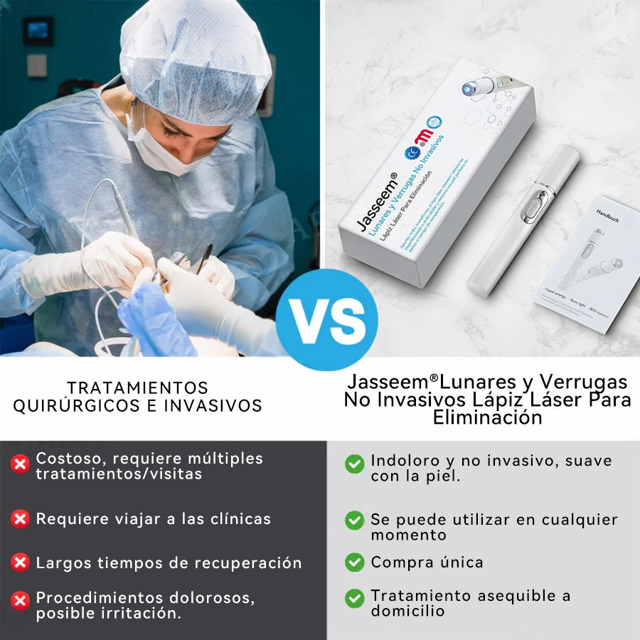𝐉𝐚𝐬𝐬𝐞𝐞𝐦® Lápiz Láser de Grado Médico 💕 (Tecnología Láser de Dióxido de Carbono – Eficaz para Eliminar Lunares, Verrugas, Excesos de Piel, Manchas de Pigmentación y Otros Defectos de la Piel) 🔥