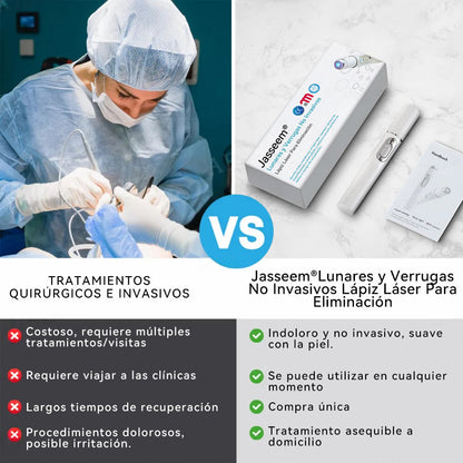 𝐉𝐚𝐬𝐬𝐞𝐞𝐦® Lápiz Láser de Grado Médico 💕 (Tecnología Láser de Dióxido de Carbono – Eficaz para Eliminar Lunares, Verrugas, Excesos de Piel, Manchas de Pigmentación y Otros Defectos de la Piel) 🔥