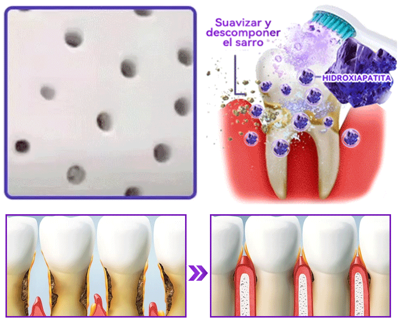 Tienda Oficial🍀|𝐷𝑜𝑟𝑚𝑜𝑟𝑛𝑎® 𝐻𝑖𝑑𝑟𝑜𝑥𝑖𝑎𝑝𝑎𝑡𝑖𝑡𝑎 𝐷𝑖𝑒𝑛𝑡𝑒𝑠 𝑅𝑒𝑝𝑎𝑟𝑎𝑐𝑖ó𝑛 𝑃𝑜𝑙𝑣𝑜🦷（Última media hora de la oferta limitada）