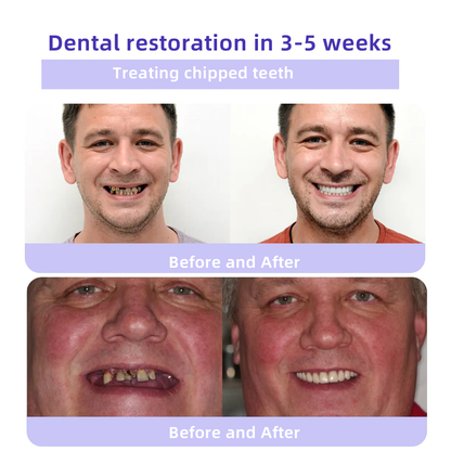 Oyikey® 🎁 Polvo Mineral para Restauración Dental (Blanqueamiento, Restauración de la Salud Dental)