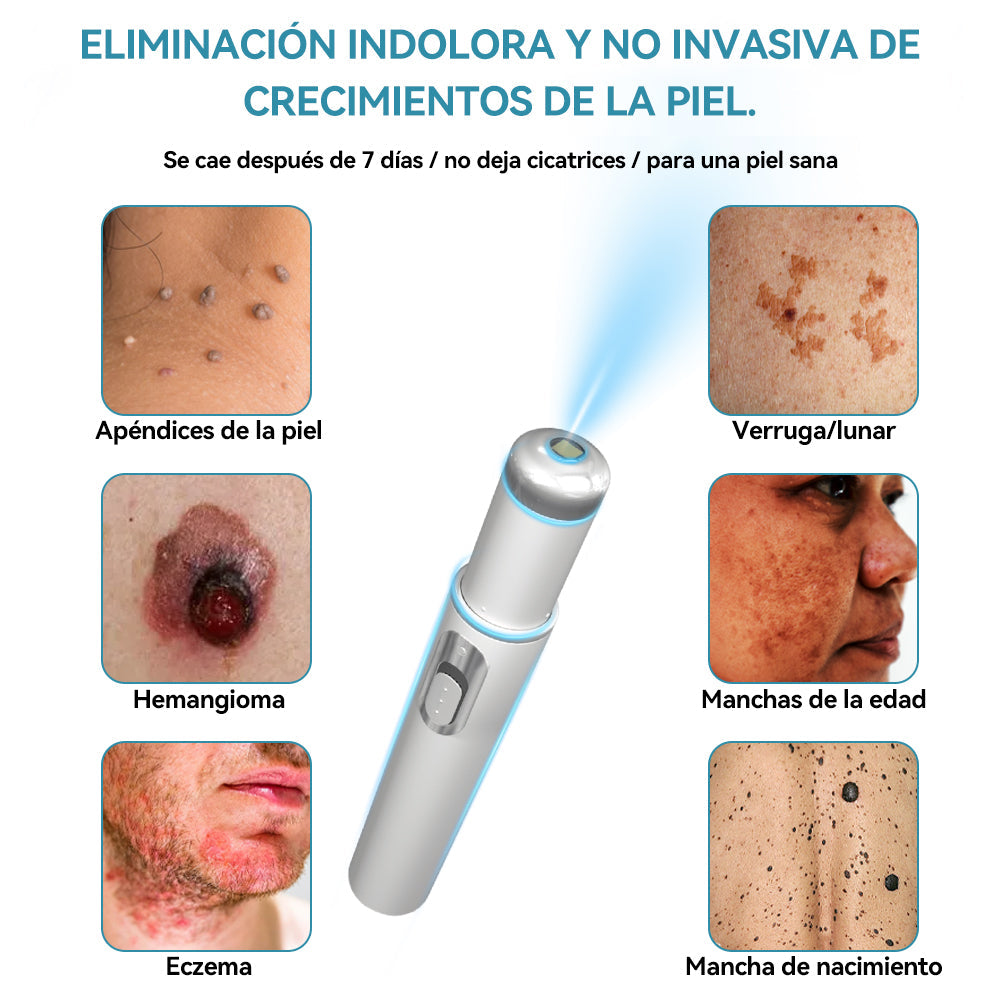𝐉𝐚𝐬𝐬𝐞𝐞𝐦® Lápiz Láser de Grado Médico 💕 (Tecnología Láser de Dióxido de Carbono – Eficaz para Eliminar Lunares, Verrugas, Excesos de Piel, Manchas de Pigmentación y Otros Defectos de la Piel) 🔥