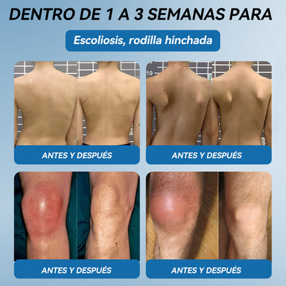 Picdo® BPC-157 Crema para la Curación de Articulaciones 💕 Trata eficazmente la artritis, la neuropatía, el reumatismo, las lesiones deportivas y más 👩‍⚕️🏆