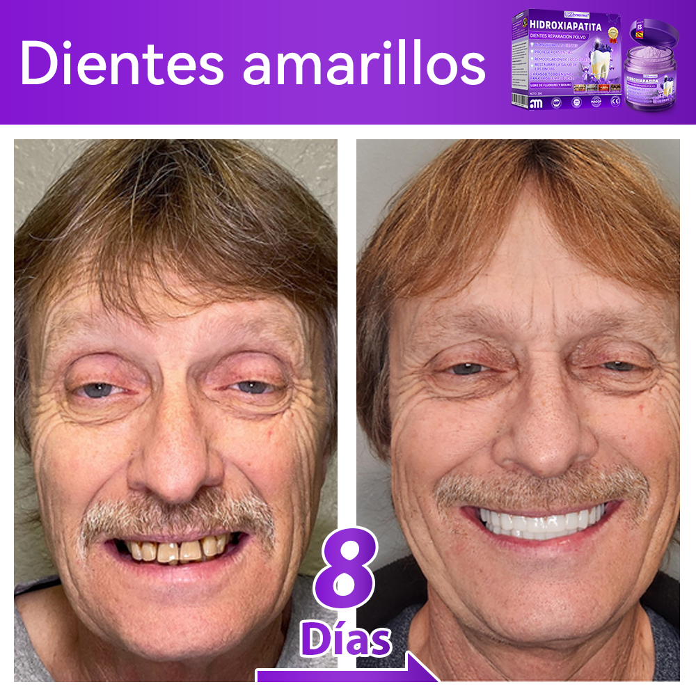 Tienda Oficial🍀|𝐷𝑜𝑟𝑚𝑜𝑟𝑛𝑎® 𝐻𝑖𝑑𝑟𝑜𝑥𝑖𝑎𝑝𝑎𝑡𝑖𝑡𝑎 𝐷𝑖𝑒𝑛𝑡𝑒𝑠 𝑅𝑒𝑝𝑎𝑟𝑎𝑐𝑖ó𝑛 𝑃𝑜𝑙𝑣𝑜🦷（Última media hora de la oferta limitada）