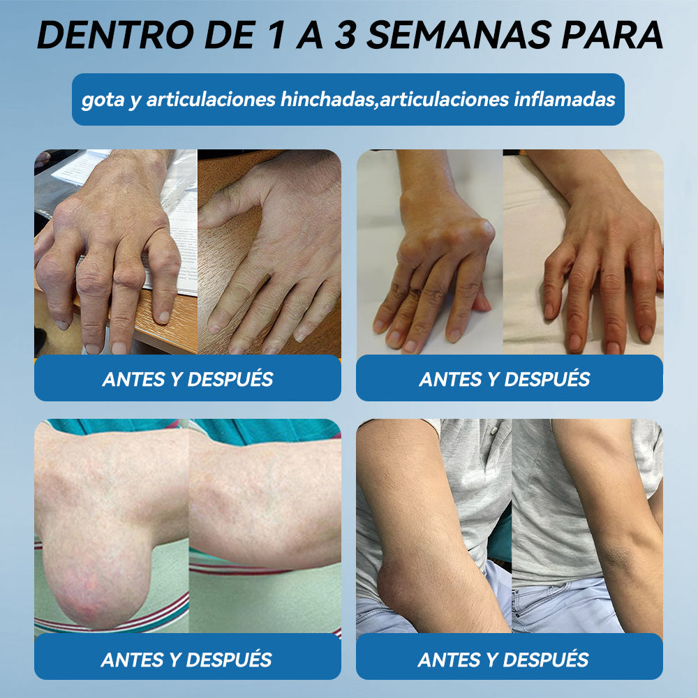 Picdo® BPC-157 Crema para la Curación de Articulaciones 💕 Trata eficazmente la artritis, la neuropatía, el reumatismo, las lesiones deportivas y más 👩‍⚕️🏆