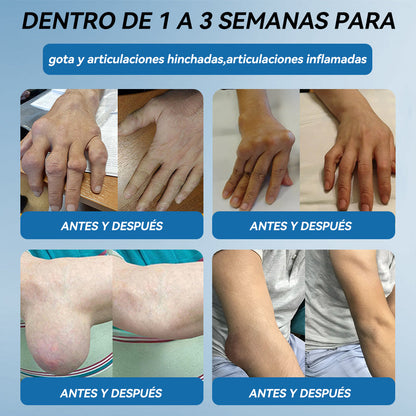 Picdo® BPC-157 Crema para la Curación de Articulaciones 💕 Trata eficazmente la artritis, la neuropatía, el reumatismo, las lesiones deportivas y más 👩‍⚕️🏆