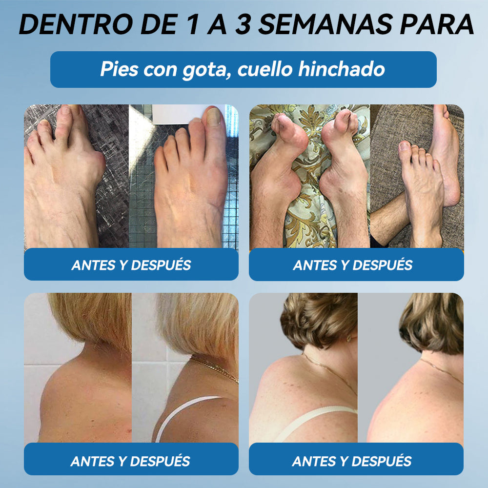 Picdo® BPC-157 Crema para la Curación de Articulaciones 💕 Trata eficazmente la artritis, la neuropatía, el reumatismo, las lesiones deportivas y más 👩‍⚕️🏆