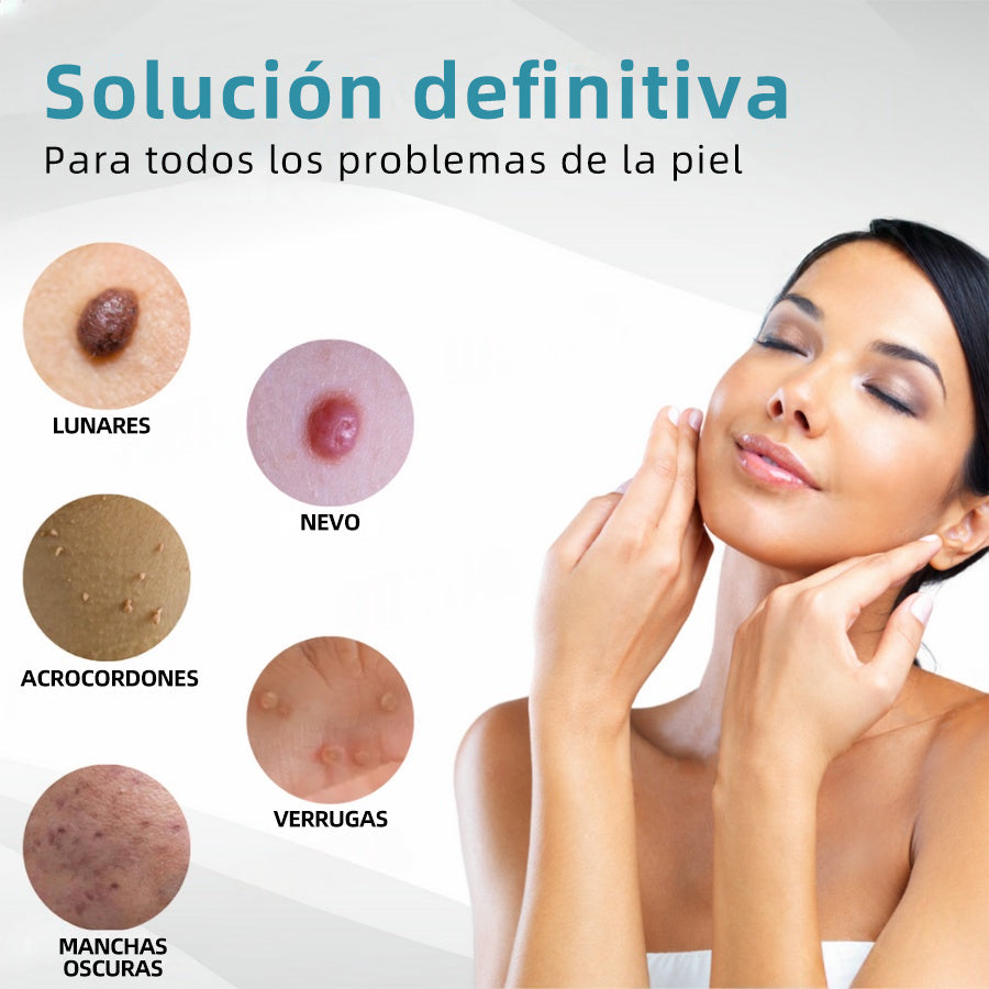 𝐉𝐚𝐬𝐬𝐞𝐞𝐦® Lápiz Láser de Grado Médico 💕 (Tecnología Láser de Dióxido de Carbono – Eficaz para Eliminar Lunares, Verrugas, Excesos de Piel, Manchas de Pigmentación y Otros Defectos de la Piel) 🔥