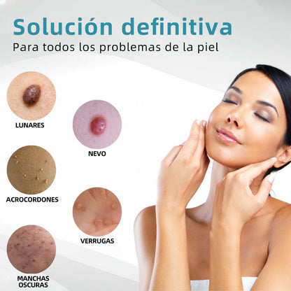 𝐉𝐚𝐬𝐬𝐞𝐞𝐦® Lápiz Láser de Grado Médico 💕 (Tecnología Láser de Dióxido de Carbono – Eficaz para Eliminar Lunares, Verrugas, Excesos de Piel, Manchas de Pigmentación y Otros Defectos de la Piel) 🔥