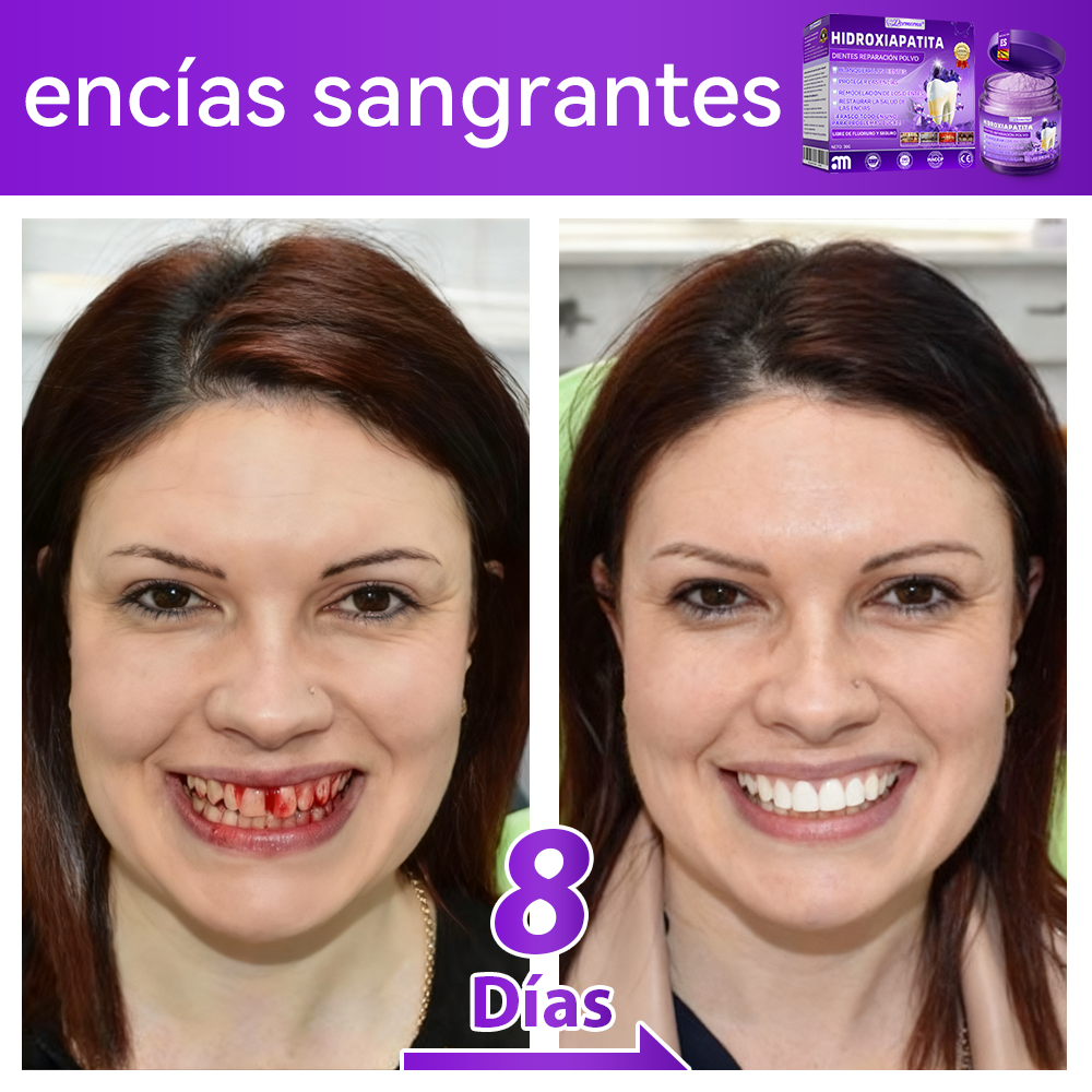 Tienda Oficial🍀|𝐷𝑜𝑟𝑚𝑜𝑟𝑛𝑎® 𝐻𝑖𝑑𝑟𝑜𝑥𝑖𝑎𝑝𝑎𝑡𝑖𝑡𝑎 𝐷𝑖𝑒𝑛𝑡𝑒𝑠 𝑅𝑒𝑝𝑎𝑟𝑎𝑐𝑖ó𝑛 𝑃𝑜𝑙𝑣𝑜🦷（Última media hora de la oferta limitada）