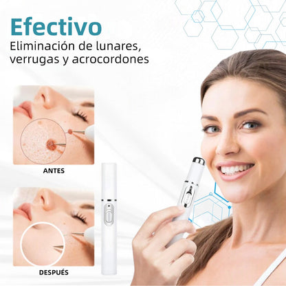 𝐉𝐚𝐬𝐬𝐞𝐞𝐦® Lápiz Láser de Grado Médico 💕 (Tecnología Láser de Dióxido de Carbono – Eficaz para Eliminar Lunares, Verrugas, Excesos de Piel, Manchas de Pigmentación y Otros Defectos de la Piel) 🔥