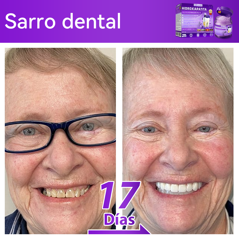 Tienda Oficial🍀|𝐷𝑜𝑟𝑚𝑜𝑟𝑛𝑎® 𝐻𝑖𝑑𝑟𝑜𝑥𝑖𝑎𝑝𝑎𝑡𝑖𝑡𝑎 𝐷𝑖𝑒𝑛𝑡𝑒𝑠 𝑅𝑒𝑝𝑎𝑟𝑎𝑐𝑖ó𝑛 𝑃𝑜𝑙𝑣𝑜🦷（Última media hora de la oferta limitada）