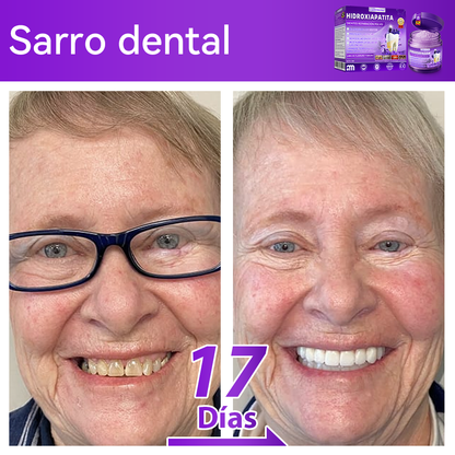 Tienda Oficial🍀|𝐷𝑜𝑟𝑚𝑜𝑟𝑛𝑎® 𝐻𝑖𝑑𝑟𝑜𝑥𝑖𝑎𝑝𝑎𝑡𝑖𝑡𝑎 𝐷𝑖𝑒𝑛𝑡𝑒𝑠 𝑅𝑒𝑝𝑎𝑟𝑎𝑐𝑖ó𝑛 𝑃𝑜𝑙𝑣𝑜🦷（Última media hora de la oferta limitada）