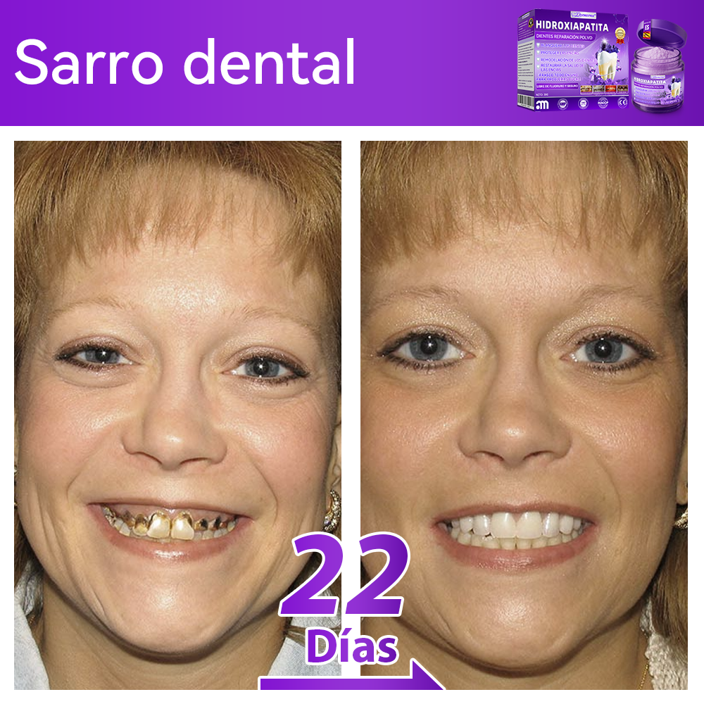 Tienda Oficial🍀|𝐷𝑜𝑟𝑚𝑜𝑟𝑛𝑎® 𝐻𝑖𝑑𝑟𝑜𝑥𝑖𝑎𝑝𝑎𝑡𝑖𝑡𝑎 𝐷𝑖𝑒𝑛𝑡𝑒𝑠 𝑅𝑒𝑝𝑎𝑟𝑎𝑐𝑖ó𝑛 𝑃𝑜𝑙𝑣𝑜🦷（Última media hora de la oferta limitada）