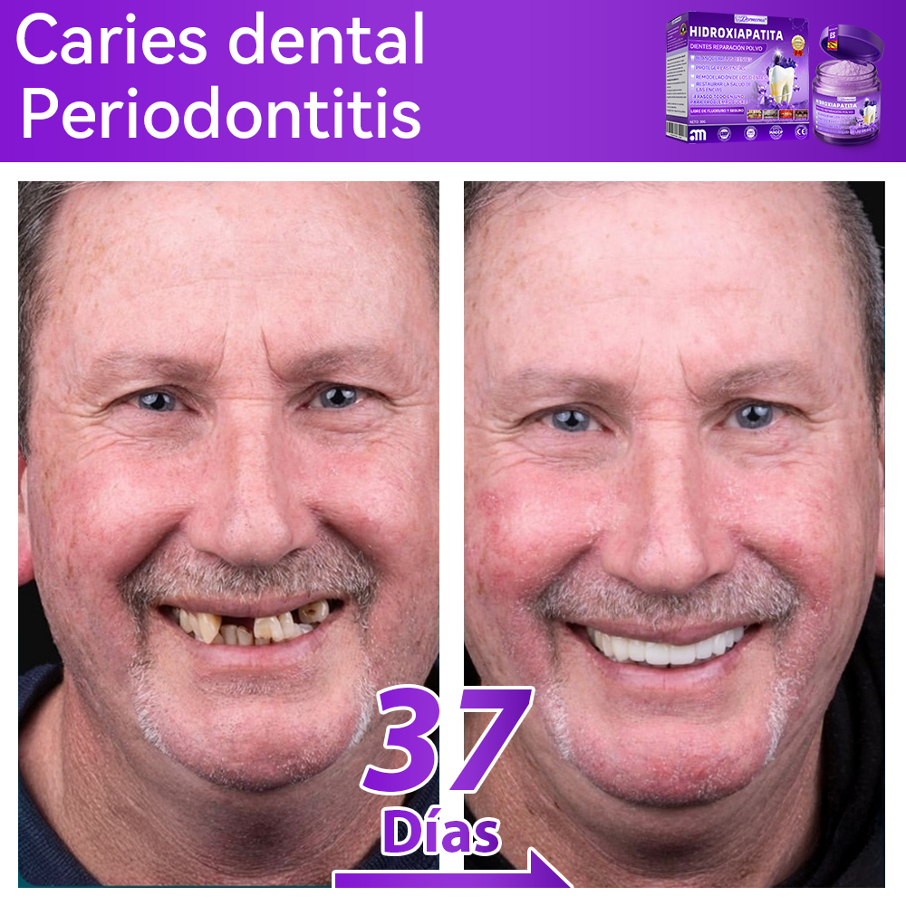 Tienda Oficial🍀|𝐷𝑜𝑟𝑚𝑜𝑟𝑛𝑎® 𝐻𝑖𝑑𝑟𝑜𝑥𝑖𝑎𝑝𝑎𝑡𝑖𝑡𝑎 𝐷𝑖𝑒𝑛𝑡𝑒𝑠 𝑅𝑒𝑝𝑎𝑟𝑎𝑐𝑖ó𝑛 𝑃𝑜𝑙𝑣𝑜🦷（Última media hora de la oferta limitada）