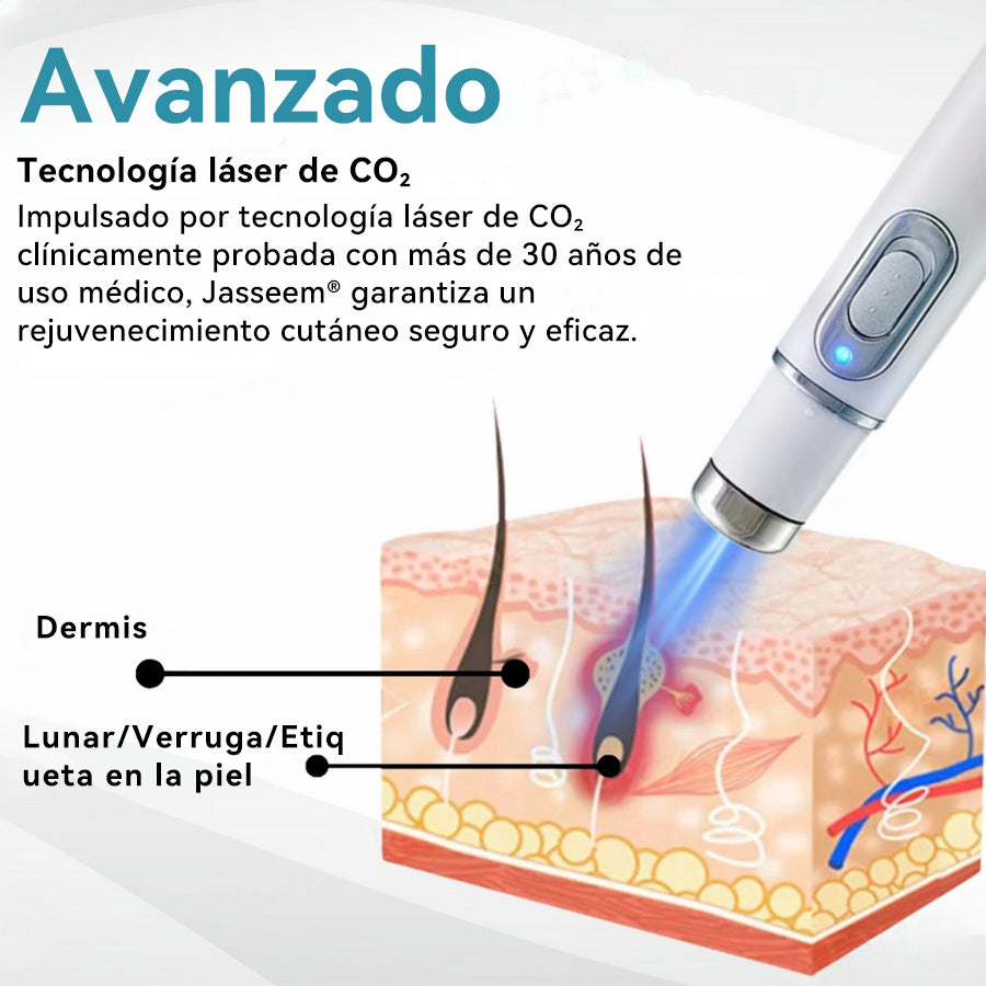 𝐉𝐚𝐬𝐬𝐞𝐞𝐦® Lápiz Láser de Grado Médico 💕 (Tecnología Láser de Dióxido de Carbono – Eficaz para Eliminar Lunares, Verrugas, Excesos de Piel, Manchas de Pigmentación y Otros Defectos de la Piel) 🔥