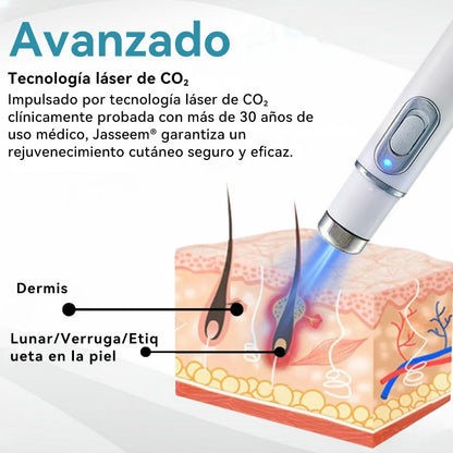 𝐉𝐚𝐬𝐬𝐞𝐞𝐦® Lápiz Láser de Grado Médico 💕 (Tecnología Láser de Dióxido de Carbono – Eficaz para Eliminar Lunares, Verrugas, Excesos de Piel, Manchas de Pigmentación y Otros Defectos de la Piel) 🔥